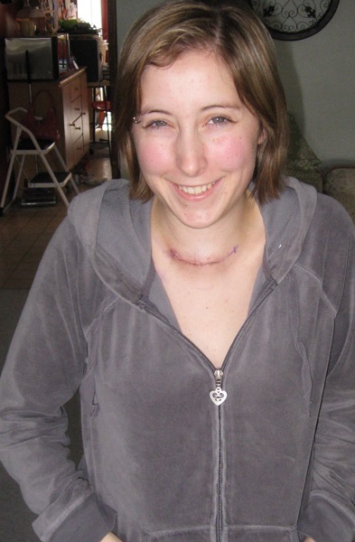 post-op