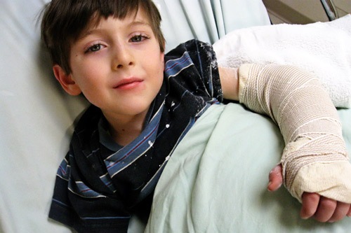 brokenarm